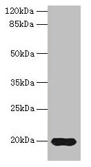 REG3G Antibody - Western blot All lanes: Regenerating islet-derived protein 3-gamma antibody at 14µg/ml + Mouse kidney tissue Secondary Goat polyclonal to rabbit IgG at 1/10000 dilution Predicted band size: 19 kDa Observed band size: 19 kDa
