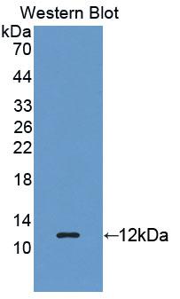 REG3G Antibody - Western blot of REG3G antibody.