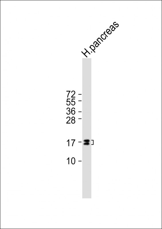 REG3G Antibody - Anti-REG3G Antibody at 1:1000 dilution + Human pancreas lysate Lysates/proteins at 20 µg per lane. Secondary Goat Anti-mouse IgG, (H+L), Peroxidase conjugated at 1/10000 dilution. Predicted band size: 19 kDa Blocking/Dilution buffer: 5% NFDM/TBST.