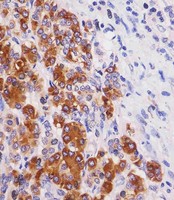 REG3G Antibody - REG3G Antibody staining REG3G in human pancreas tissue sections by Immunohistochemistry (IHC-P - paraformaldehyde-fixed, paraffin-embedded sections). Tissue was fixed with formaldehyde and blocked with 3% BSA for 0. 5 hour at room temperature; antigen retrieval was by heat mediation with a citrate buffer (pH6). Samples were incubated with primary antibody (1/25) for 1 hours at 37°C. A undiluted biotinylated goat polyvalent antibody was used as the secondary antibody.