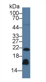 REG3G Antibody - Western Blot; Sample: Human Serum; Primary Ab: 3µg/ml Mouse Anti-Human REG3g Antibody Second Ab: 0.2µg/mL HRP-Linked Caprine Anti-Mouse IgG Polyclonal Antibody