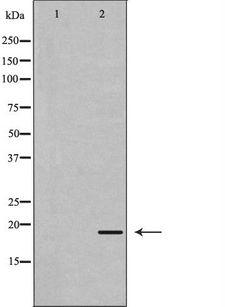 REG3G Antibody - Western blot analysis of extracts of mouse kidney tissue using REG3G antibody. The lane on the left is treated with the antigen-specific peptide.