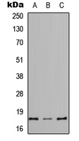REG4 / REG-IV Antibody - Western blot analysis of REG4 expression in HEK293T (A); Raw264.7 (B); H9C2 (C) whole cell lysates.