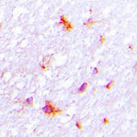 REG4 / REG-IV Antibody - Immunohistochemical analysis of REG4 staining in human brain formalin fixed paraffin embedded tissue section. The section was pre-treated using heat mediated antigen retrieval with sodium citrate buffer (pH 6.0). The section was then incubated with the antibody at room temperature and detected using an HRP conjugated compact polymer system. DAB was used as the chromogen. The section was then counterstained with hematoxylin and mounted with DPX. w
