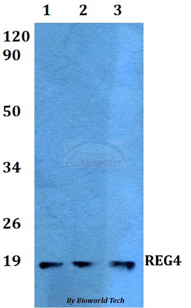 REG4 / REG-IV Antibody - Western blot of REG4 antibody at 1:500 dilution. Lane 1: HEK293T whole cell lysate. Lane 2: Raw264.7 whole cell lysate. Lane 3: H9C2 whole cell lysate.