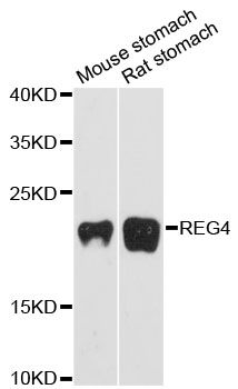 REG4 / REG-IV Antibody - Western blot analysis of extracts of various cell lines, using REG4 antibody at 1:3000 dilution. The secondary antibody used was an HRP Goat Anti-Rabbit IgG (H+L) at 1:10000 dilution. Lysates were loaded 25ug per lane and 3% nonfat dry milk in TBST was used for blocking. An ECL Kit was used for detection and the exposure time was 90s.