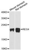 REG4 / REG-IV Antibody - Western blot analysis of extracts of various cell lines, using REG4 antibody at 1:3000 dilution. The secondary antibody used was an HRP Goat Anti-Rabbit IgG (H+L) at 1:10000 dilution. Lysates were loaded 25ug per lane and 3% nonfat dry milk in TBST was used for blocking. An ECL Kit was used for detection and the exposure time was 90s.