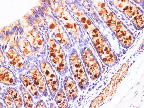 REG4 / REG-IV Antibody - Immunohistochemistry of paraffin-embedded Mouse colon using REG4 Polyclonl Antibody at dilution of 1:200(400×).