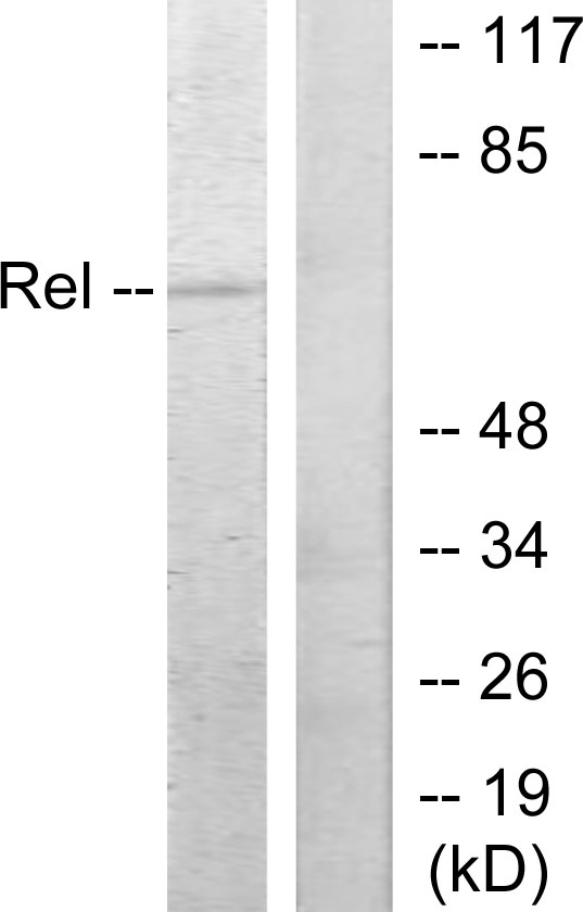 REL / C-Rel Antibody - Western blot analysis of lysates from MDA-MB-435 cells, using Rel Antibody. The lane on the right is blocked with the synthesized peptide.