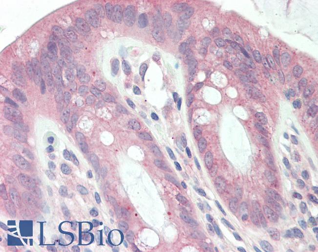 REL / C-Rel Antibody - Anti-REL / C-Rel antibody IHC staining of human colon. Immunohistochemistry of formalin-fixed, paraffin-embedded tissue after heat-induced antigen retrieval. Antibody concentration 5 ug/ml.  This image was taken for the unconjugated form of this product. Other forms have not been tested.