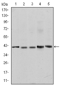 REL / C-Rel Antibody - Western blot using c-Rel mouse monoclonal antibody against Jurkat (1), NIH/3T3 (2), HeLa (3), HEK293 (4) and RAJI (5) cell lysate.