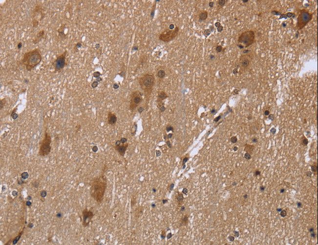 REL / C-Rel Antibody - Immunohistochemistry of paraffin-embedded Human brain using REL Polyclonal Antibody at dilution of 1:30.