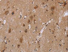 REL / C-Rel Antibody - Immunohistochemistry of paraffin-embedded Human brain using REL Polyclonal Antibody at dilution of 1:30.