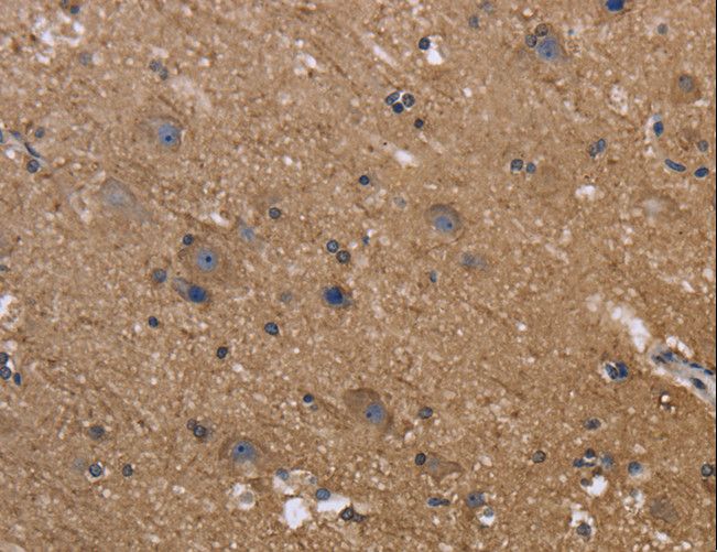 REL / C-Rel Antibody - Immunohistochemistry of paraffin-embedded Human brain using REL Polyclonal Antibody at dilution of 1:50.