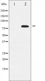 REL / C-Rel Antibody - Western blot analysis of Rel expression in MDA-MB-435 whole cells lysates. The lane on the left is treated with the antigen-specific peptide.