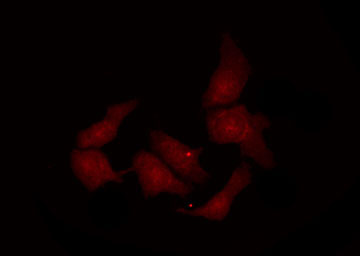 REL / C-Rel Antibody - Staining MDA-MB-435 cells by IF/ICC. The samples were fixed with PFA and permeabilized in 0.1% Triton X-100, then blocked in 10% serum for 45 min at 25°C. The primary antibody was diluted at 1:200 and incubated with the sample for 1 hour at 37°C. An Alexa Fluor 594 conjugated goat anti-rabbit IgG (H+L) Ab, diluted at 1/600, was used as the secondary antibody.