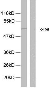 REL / C-Rel Antibody - Western blot analysis of lysates from MDA-MB-435 cells, using Rel (Phospho-Ser503) Antibody. The lane on the right is blocked with the phospho peptide.