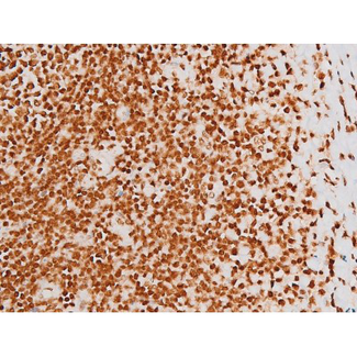 REL / C-Rel Antibody - 1:200 staining human tonsil tissue by IHC-P. The tissue was formaldehyde fixed and a heat mediated antigen retrieval step in citrate buffer was performed. The tissue was then blocked and incubated with the antibody for 1.5 hours at 22°C. An HRP conjugated goat anti-rabbit antibody was used as the secondary.