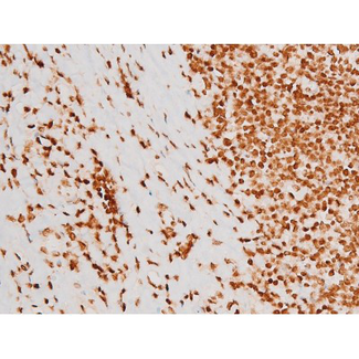 REL / C-Rel Antibody - 1:200 staining human tonsil tissue by IHC-P. The tissue was formaldehyde fixed and a heat mediated antigen retrieval step in citrate buffer was performed. The tissue was then blocked and incubated with the antibody for 1.5 hours at 22°C. An HRP conjugated goat anti-rabbit antibody was used as the secondary.