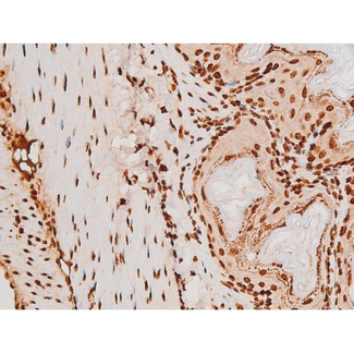 REL / C-Rel Antibody - 1:200 staining mouse ganstric tissue by IHC-P. The tissue was formaldehyde fixed and a heat mediated antigen retrieval step in citrate buffer was performed. The tissue was then blocked and incubated with the antibody for 1.5 hours at 22°C. An HRP conjugated goat anti-rabbit antibody was used as the secondary.