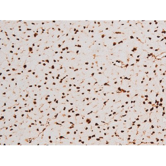 REL / C-Rel Antibody - 1:200 staining mouse heart tissue by IHC-P. The tissue was formaldehyde fixed and a heat mediated antigen retrieval step in citrate buffer was performed. The tissue was then blocked and incubated with the antibody for 1.5 hours at 22°C. An HRP conjugated goat anti-rabbit antibody was used as the secondary.