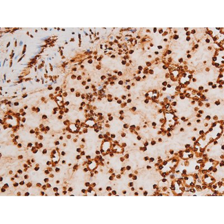REL / C-Rel Antibody - 1:200 staining mouse kidney tissue by IHC-P. The tissue was formaldehyde fixed and a heat mediated antigen retrieval step in citrate buffer was performed. The tissue was then blocked and incubated with the antibody for 1.5 hours at 22°C. An HRP conjugated goat anti-rabbit antibody was used as the secondary.