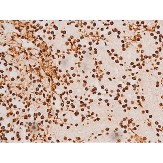 REL / C-Rel Antibody - 1:200 staining rat kidney tissue by IHC-P. The tissue was formaldehyde fixed and a heat mediated antigen retrieval step in citrate buffer was performed. The tissue was then blocked and incubated with the antibody for 1.5 hours at 22°C. An HRP conjugated goat anti-rabbit antibody was used as the secondary.
