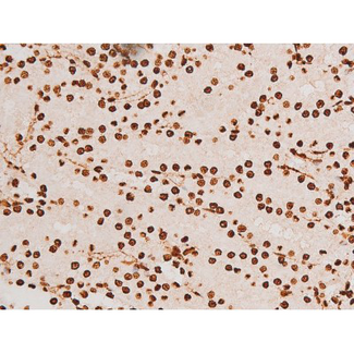 REL / C-Rel Antibody - 1:200 staining rat kidney tissue by IHC-P. The tissue was formaldehyde fixed and a heat mediated antigen retrieval step in citrate buffer was performed. The tissue was then blocked and incubated with the antibody for 1.5 hours at 22°C. An HRP conjugated goat anti-rabbit antibody was used as the secondary.