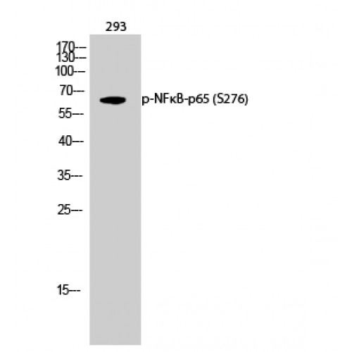 RELA / NFKB p65 Antibody - Western blot of Phospho-NFkappaB-p65 (S276) antibody