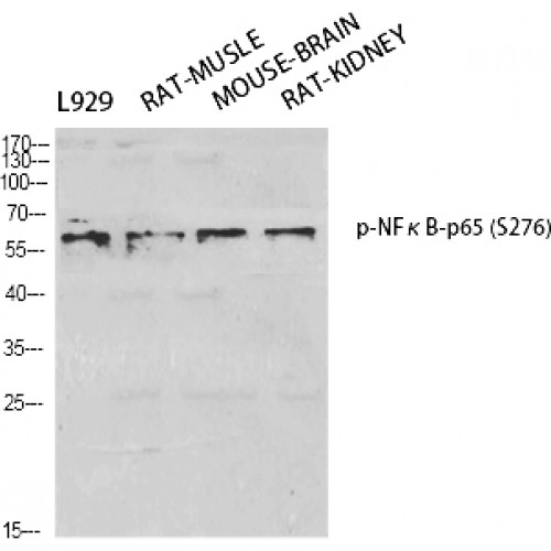 RELA / NFKB p65 Antibody - Western blot of Phospho-NFkappaB-p65 (S276) antibody