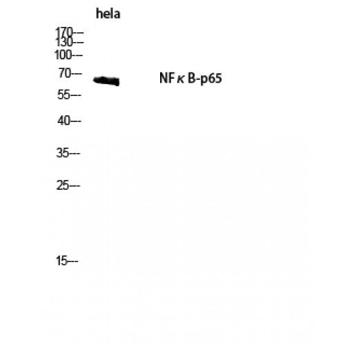 RELA / NFKB p65 Antibody - Western blot of NFkappaB-p65 antibody