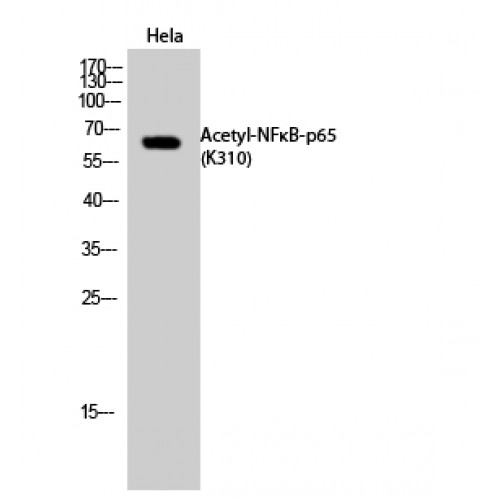 RELA / NFKB p65 Antibody - Western blot of Acetyl-NFkappaB-p65 (K310) antibody