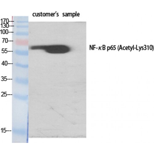 RELA / NFKB p65 Antibody - Western blot of Acetyl-NFkappaB-p65 (K310) antibody