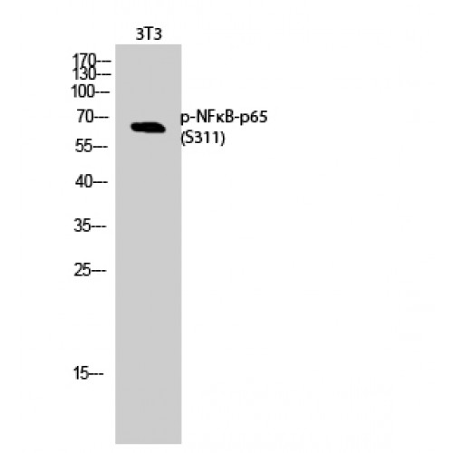 RELA / NFKB p65 Antibody - Western blot of Phospho-NFkappaB-p65 (S311) antibody