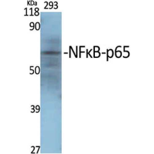 RELA / NFKB p65 Antibody - Western blot of NFkappaB-p65 antibody