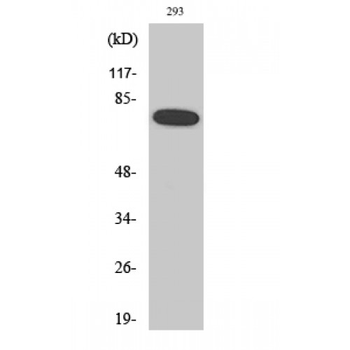 RELA / NFKB p65 Antibody - Western blot of Phospho-NFkappaB-p65 (S468) antibody