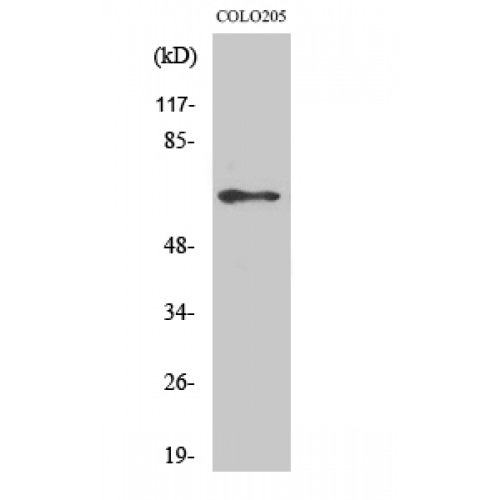 RELA / NFKB p65 Antibody - Western blot of Phospho-NFkappaB-p65 (S536) antibody