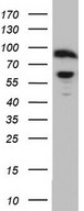 RELA / NFKB p65 Antibody - Western blot of MCF7 cell lysate (35ug) by using Rabbit polyclonal anti-RELA antibody at 1:2000 dilution.
