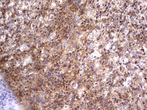 RELA / NFKB p65 Antibody - IHC of paraffin-embedded Human lymph node tissue using Rabbit polyclonal anti-RELA antibody at (Heat-induced epitope retrieval by 1 mM EDTA in 10mM Tris, pH8.5, 120°C for 3min).