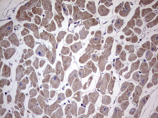 RELA / NFKB p65 Antibody - IHC of paraffin-embedded Human adult heart tissue using Rabbit polyclonal anti-RELA antibody at (Heat-induced epitope retrieval by 1 mM EDTA in 10mM Tris, pH8.5, 120°C for 3min).