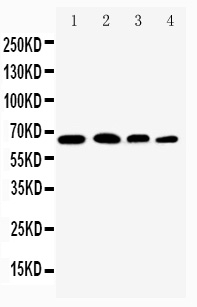 RELA / NFKB p65 Antibody - Anti-NF-kB p65 antibody, Western blotting Lane 1: Rat Testis Tissue Lysate Lane 2: HELA Cell Lysate Lane 3: A431 Cell Lysate Lane 4: JURKAT Cell Lysate