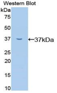 RELA / NFKB p65 Antibody - Western blot of recombinant RELA / NFKB p65.  This image was taken for the unconjugated form of this product. Other forms have not been tested.