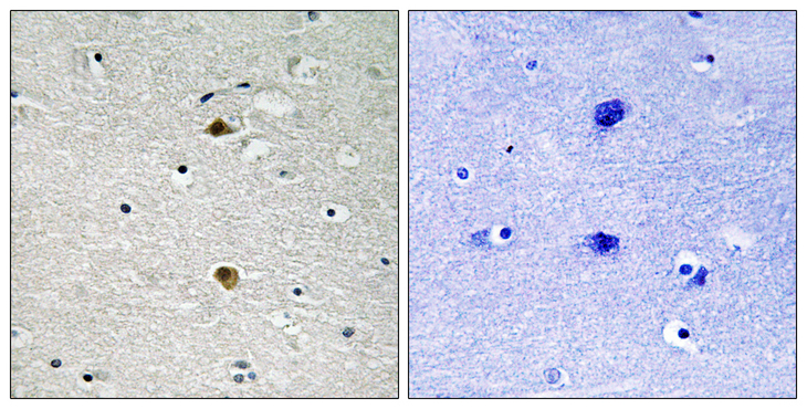 RELA / NFKB p65 Antibody - Immunohistochemistry analysis of paraffin-embedded human brain tissue, using NF-kappaB p65 Antibody. The picture on the right is blocked with the synthesized peptide.