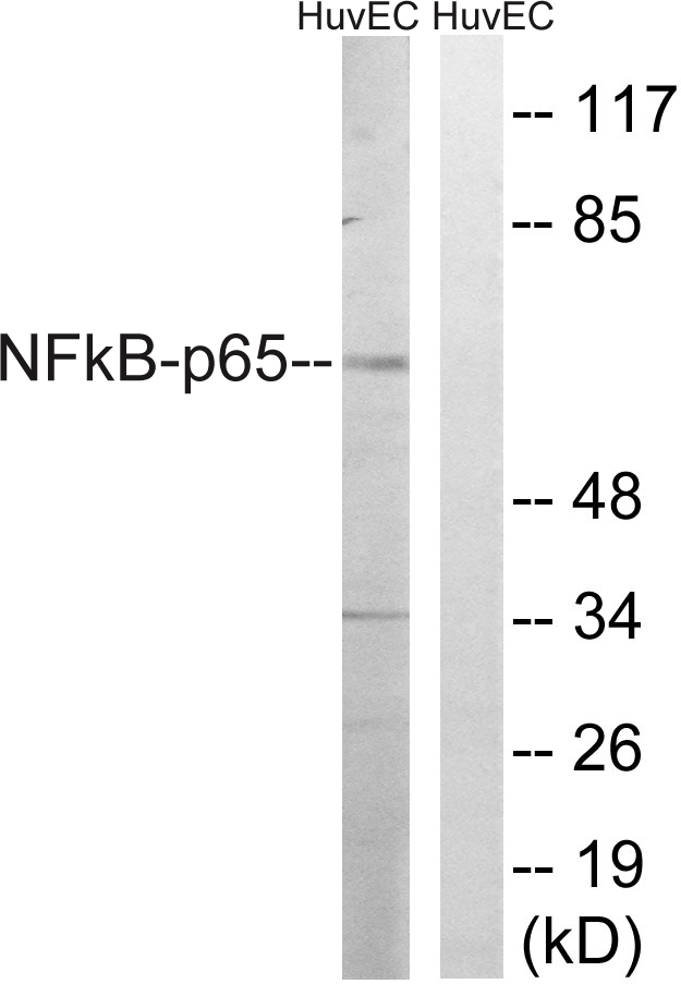 RELA / NFKB p65 Antibody - Western blot analysis of lysates from HUVEC cells, treated with EPO 20U/ml 15', using NF-kappaB p65 Antibody. The lane on the right is blocked with the synthesized peptide.