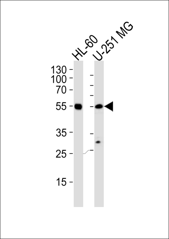 RELA / NFKB p65 Antibody - Western blot of lysates from HL-60, U251 MG cell line (from left to right), using RELA Antibody. Antibody was diluted at 1:1000 at each lane. A goat anti-rabbit IgG H&L (HRP) at 1:5000 dilution was used as the secondary antibody. Lysates at 35ug per lane.