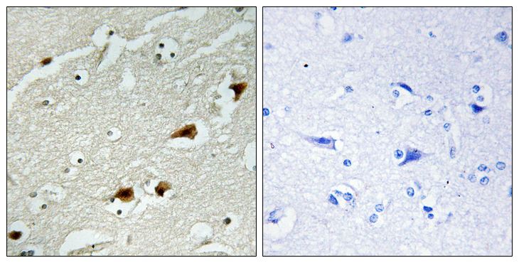 RELA / NFKB p65 Antibody - Immunohistochemistry analysis of paraffin-embedded human brain tissue, using NF-kappaB p65 Antibody. The picture on the right is blocked with the synthesized peptide.