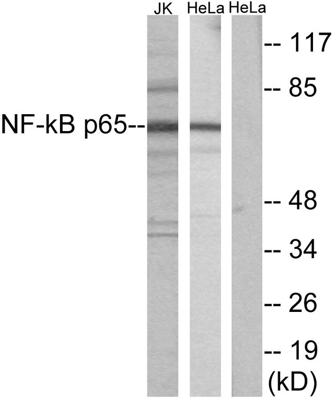 RELA / NFKB p65 Antibody - Western blot analysis of lysates from Jurkat/HeLa, using NF-kappaB p65 Antibody. The lane on the right is blocked with the synthesized peptide.