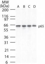 RELA / NFKB p65 Antibody - Western Blot: NFkB p65 Antibody (112A1021) [Azide Free] - analysis of p65 using p65 antibody at 2 ug/ml in 30 ug of A) Ramos, B) Daudi, C) HeLa and D) mouse NIH 3T3 cell lysate. This image was taken for the unmodified form of this product. Other forms have not been tested.
