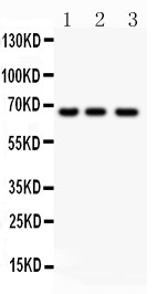 RELA / NFKB p65 Antibody - NF-kB p65 antibody Western blot. All lanes: Anti- NF-kB p65 at 0.5 ug/ml. Lane 1: Jurkat Whole Cell Lysate at 40 ug. Lane 2: Colo320 Whole Cell Lysate at 40 ug. Lane 3: HeLa Whole Cell Lysate at 40 ug. Predicted band size: 64 kD. Observed band size: 64 kD.
