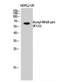 RELA / NFKB p65 Antibody - Western blot of Acetyl-NFkappaB-p65 (K122) antibody